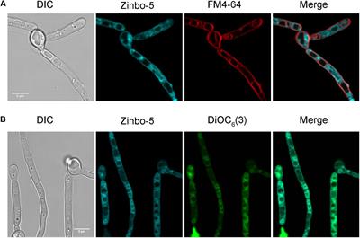 Cyclic AMP Pathway Activation and Extracellular Zinc Induce Rapid Intracellular Zinc Mobilization in Candida albicans